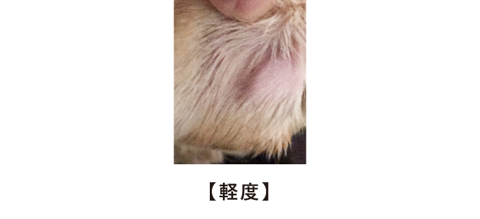 耳の外の腫れ