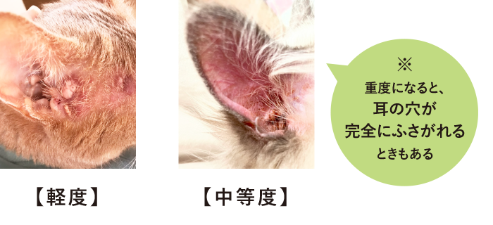 耳　腫れ