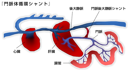 門脈シャント