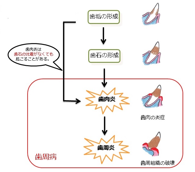 うつる 蓄膿症