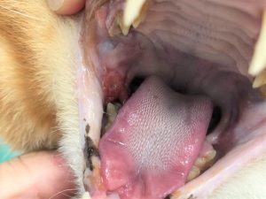 向かって左奥の歯肉部分の炎症