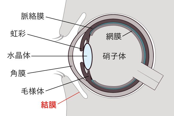 そう ろう 防止 薬 リング