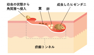 【獣医師監修】インコに多い「疥癬症」とは? | 鳥との暮らし大百科